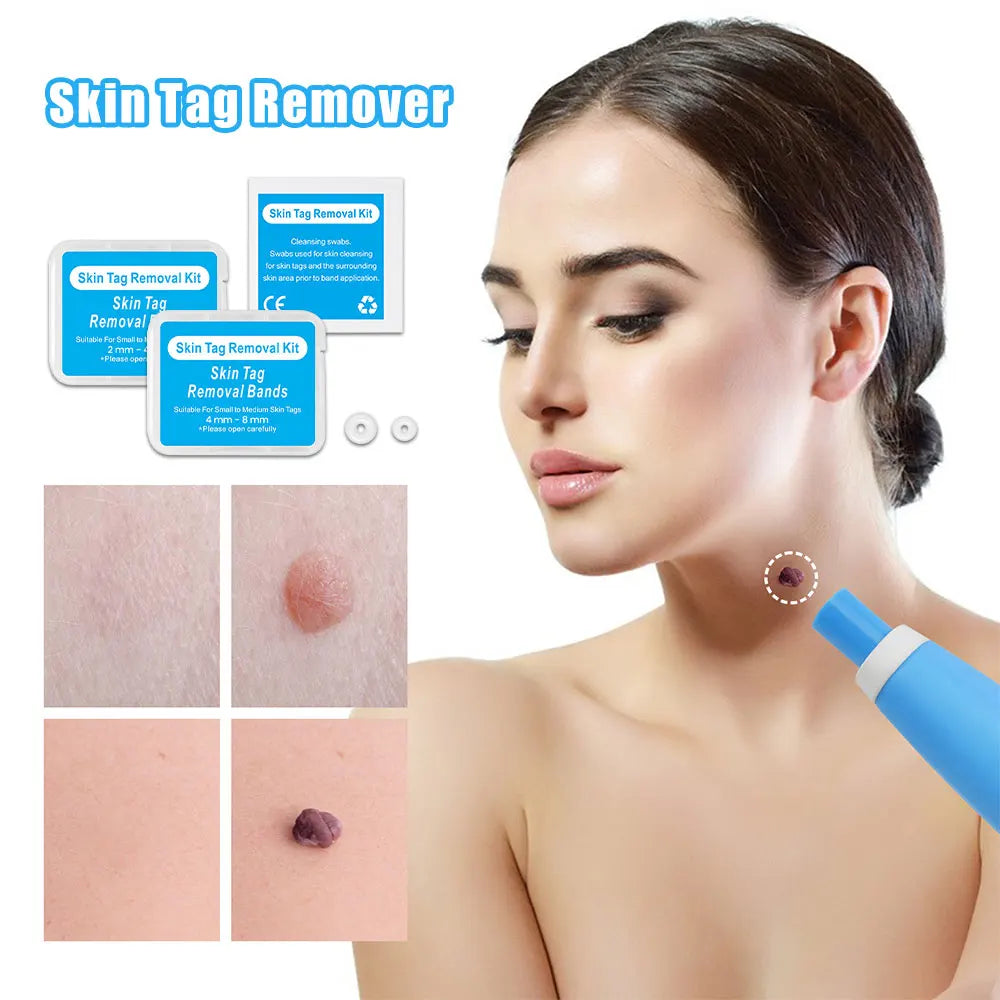 TagBuddy: Skin Tag Remover