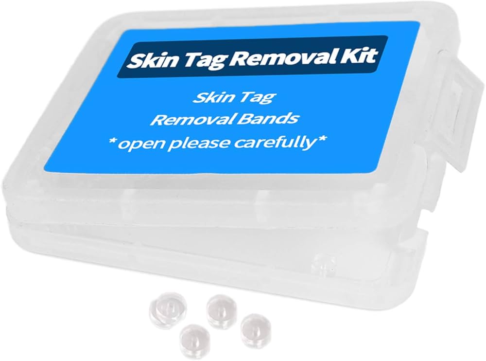 Extra Vascular Micro-Bands