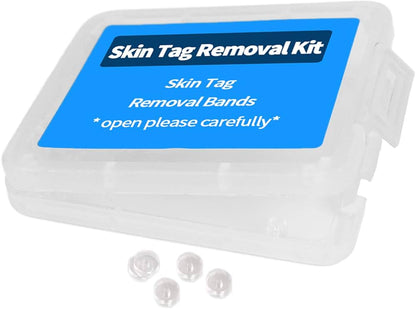 Extra Vascular Micro-Bands