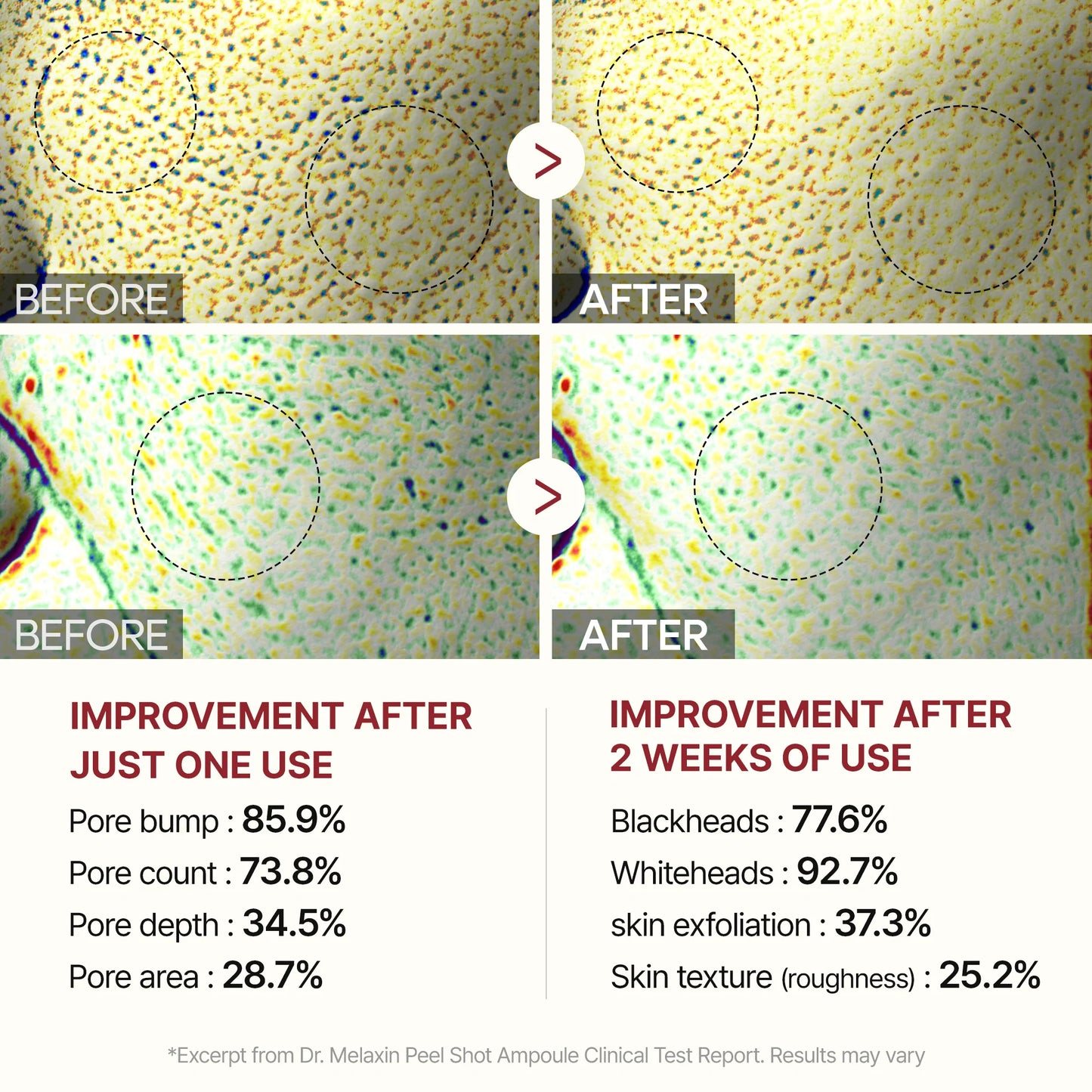 Alluressence Exfoliating Serum