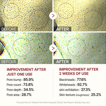 Alluressence Exfoliating Serum