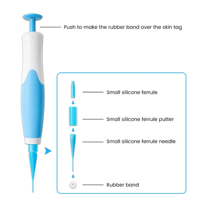 TagBuddy: Skin Tag Remover