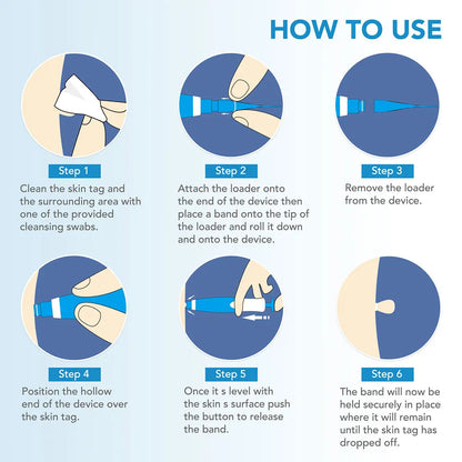 TagBuddy: Skin Tag Remover